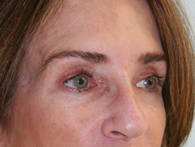 gal-image