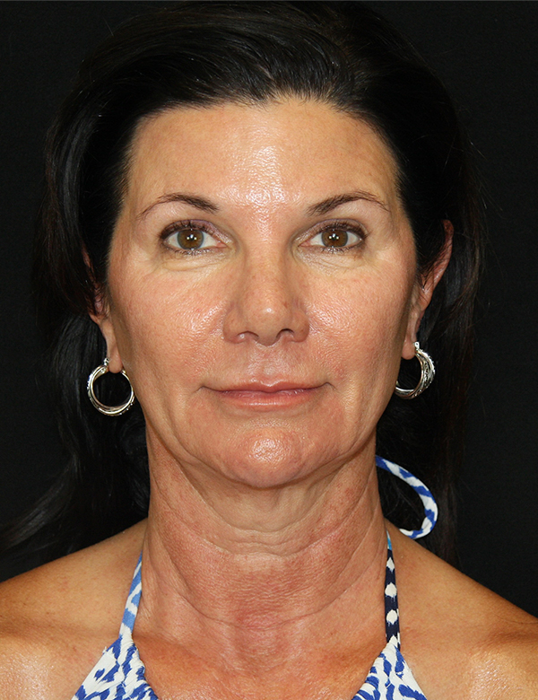 gal-image