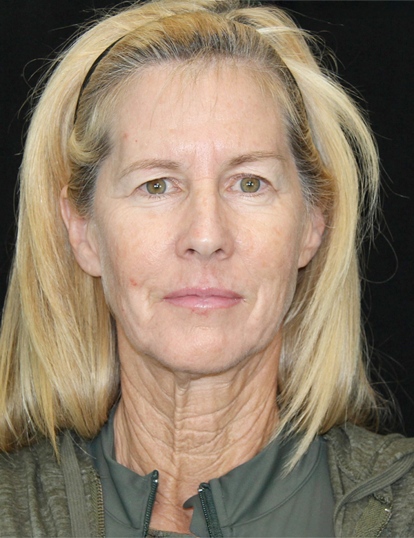 gal-image