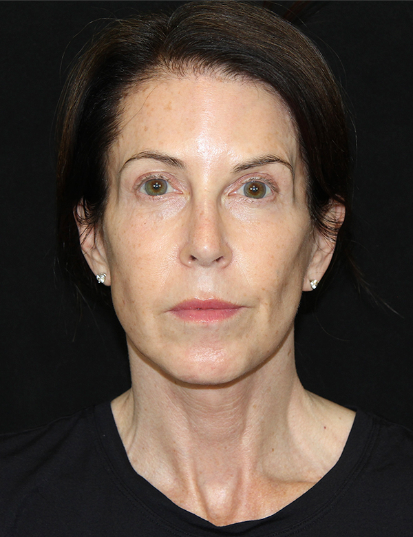gal-image