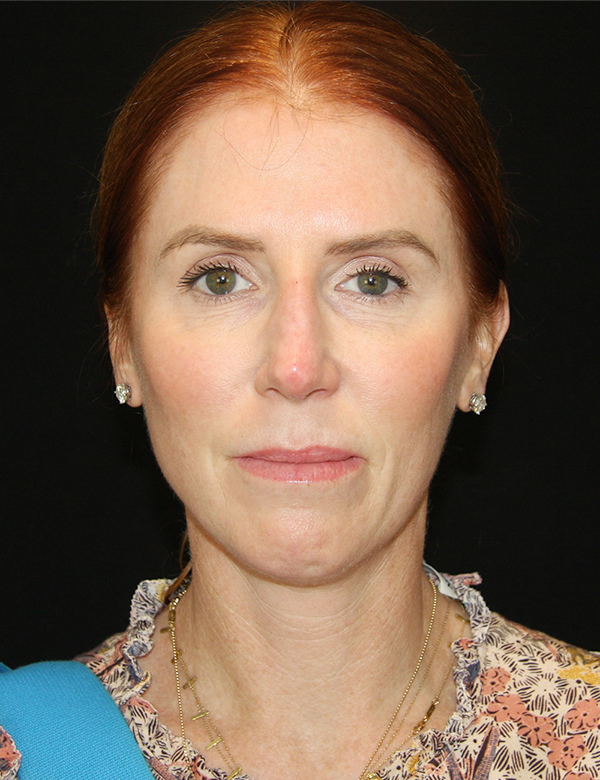 gal-image