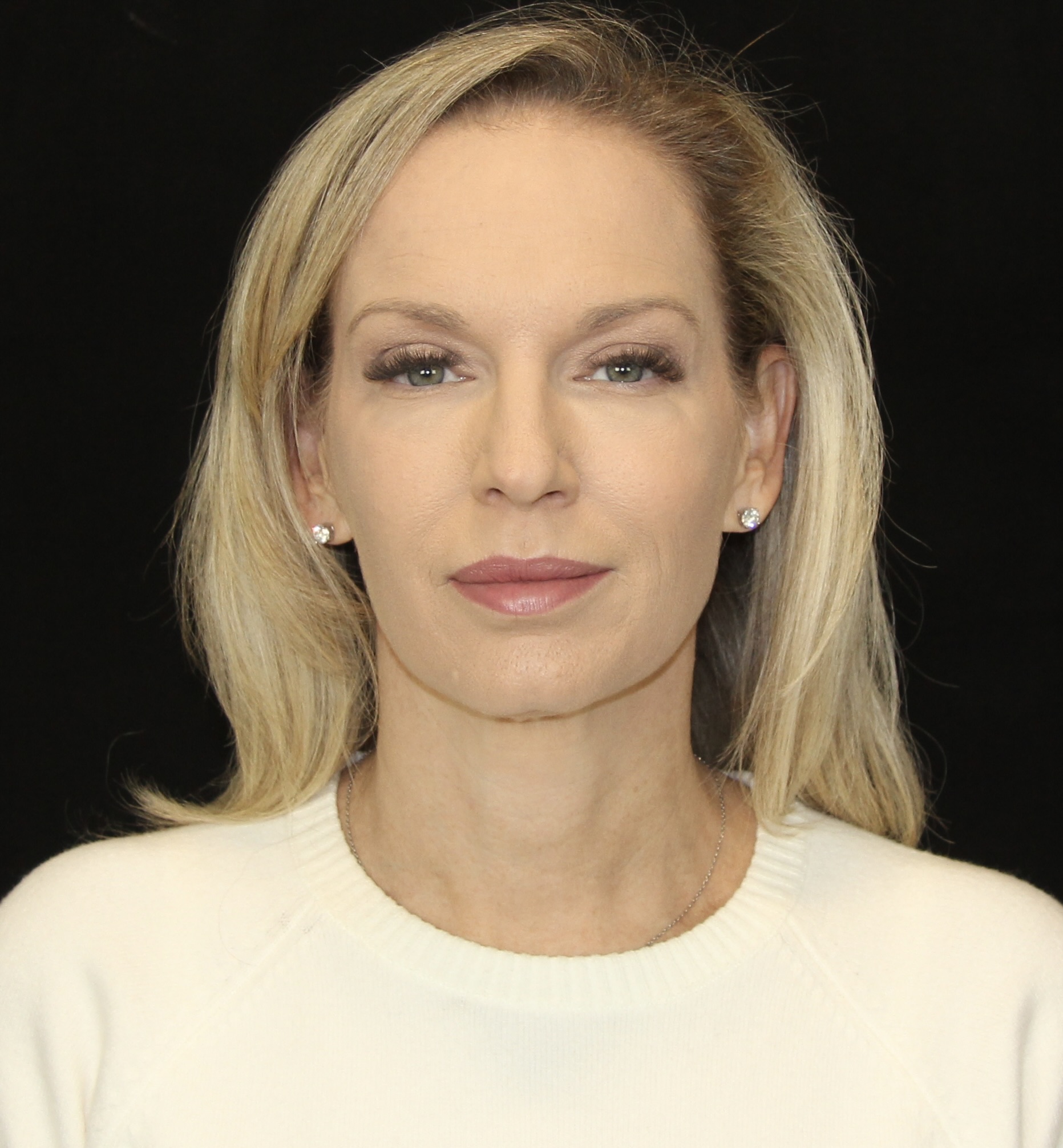 gal-image