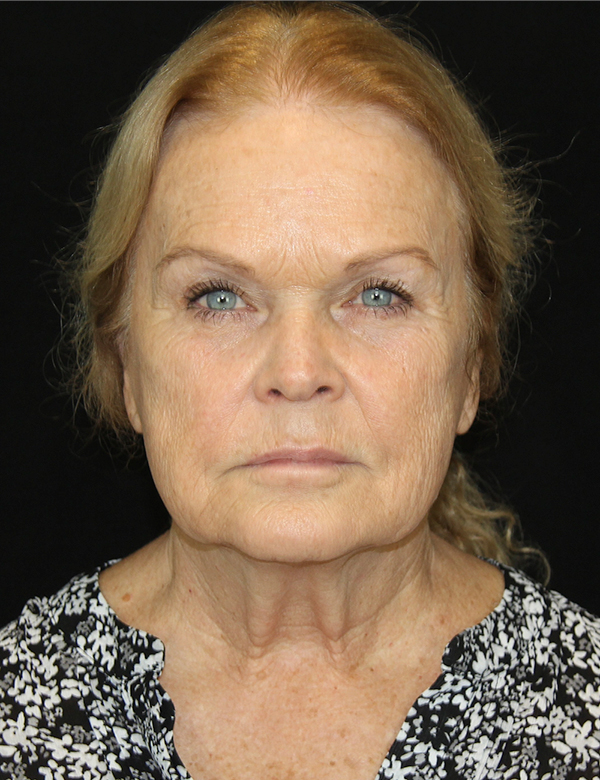 gal-image