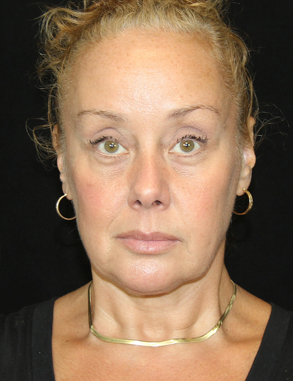 gal-image