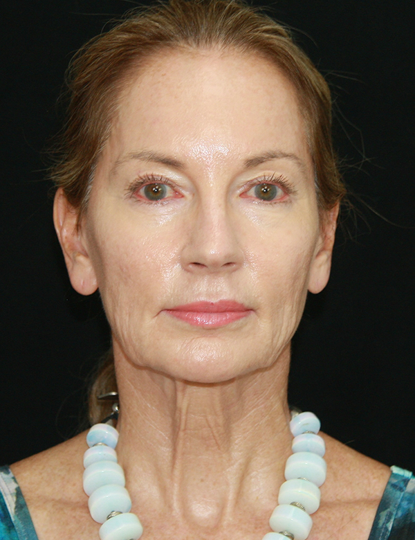 gal-image