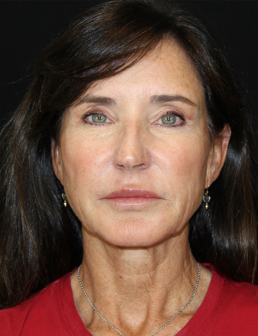 gal-image